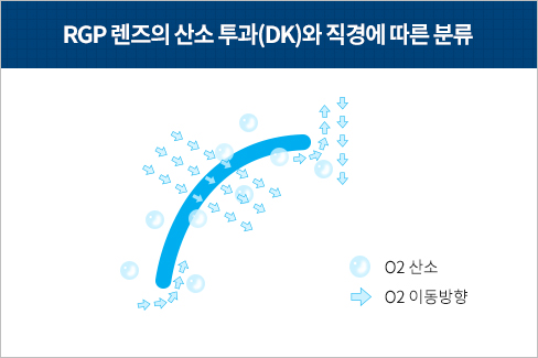 RGP 렌즈의 산소 투과(DK)와 직경에 따른 분류 